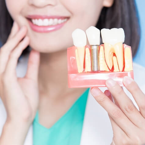 Smiling dentist holding up model of dental implants