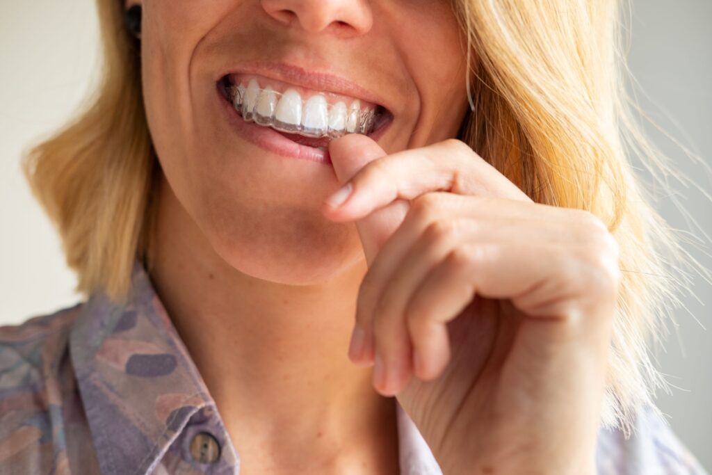 Nose-to-neck view of woman inserting Invisalign 